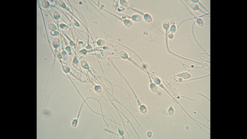 I Took My Semen And Put It Under My Microscope – 1000x Magnification