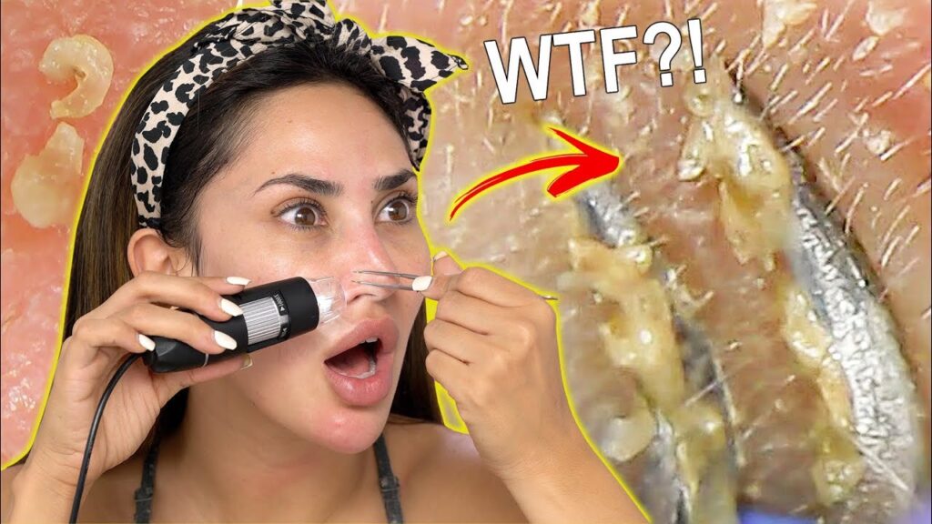 NOSE EXTRACTIONS UNDER A MICROSCOPE! | BrittanyBearMakeup